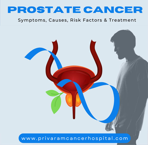 Prostate Cancer Symptoms Causes Risk Factors And Treatment Privaram Cancer And Research 1083