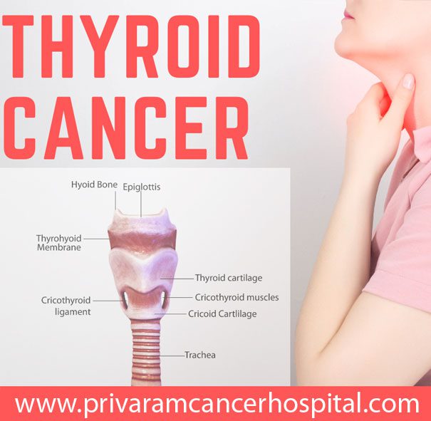 Thyroid Cancer